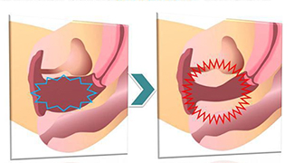 Vaginal-tightening-Tunisia